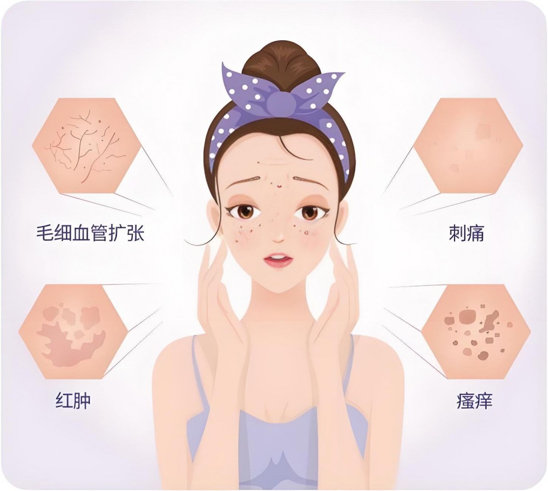 敏感肌的急救站！舒敏之星——你的肌肤屏障修复神器！