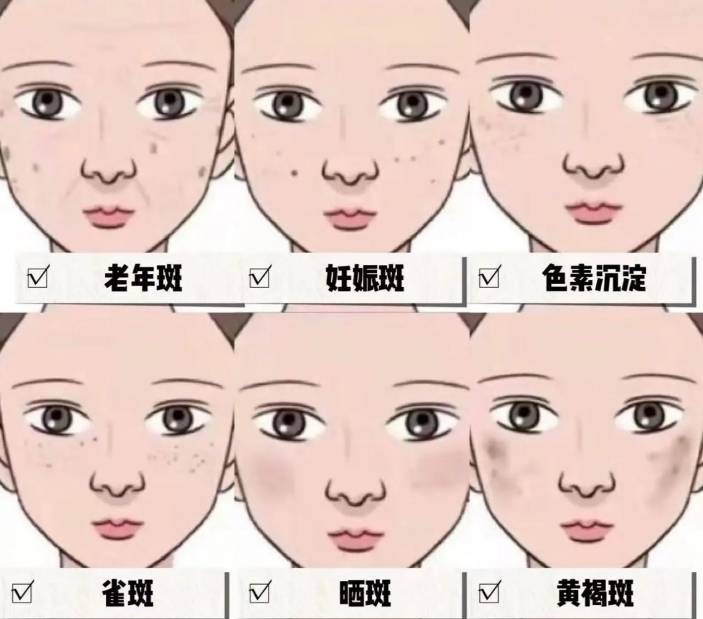 告别色素烦恼，焕发无瑕美肌！——巴中博雅Pastelle调Q激光，你的专业色素解决方案！